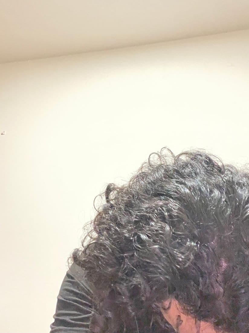 Side of the head with hair pulled back showing the scalp through a part