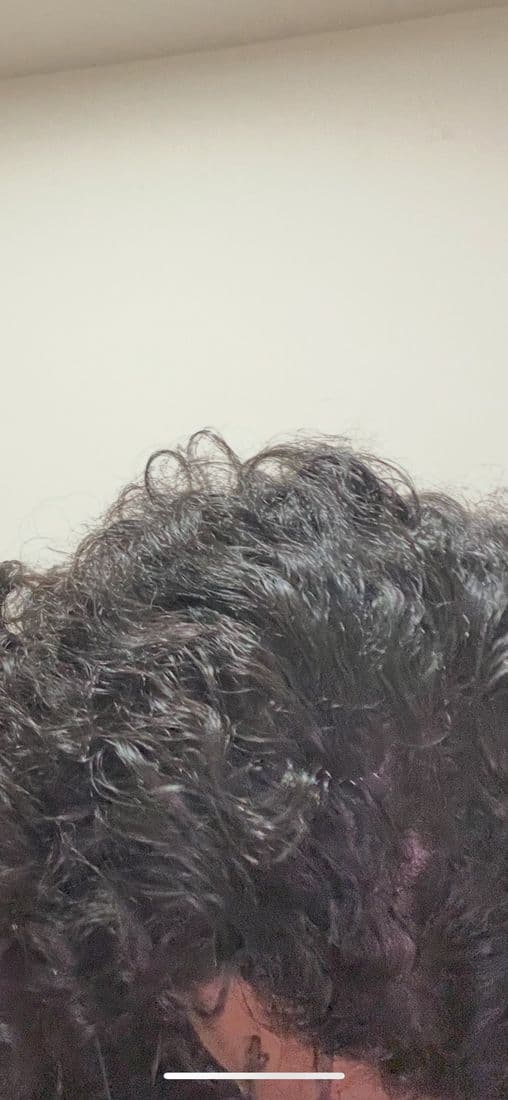 Close-up of a thinning spot on the scalp