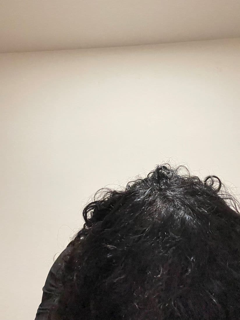 Top of the head parted during serum application